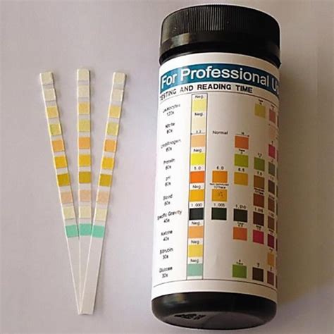 bottle strip test|urine dipstick test strips.